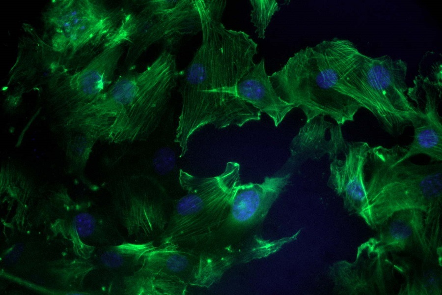 3T3 cells on silk surface with TGF beta.